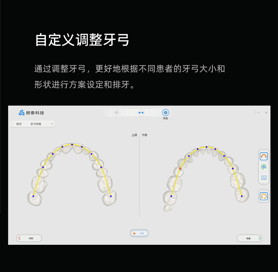 牙弓調整-2023871340391.gif
